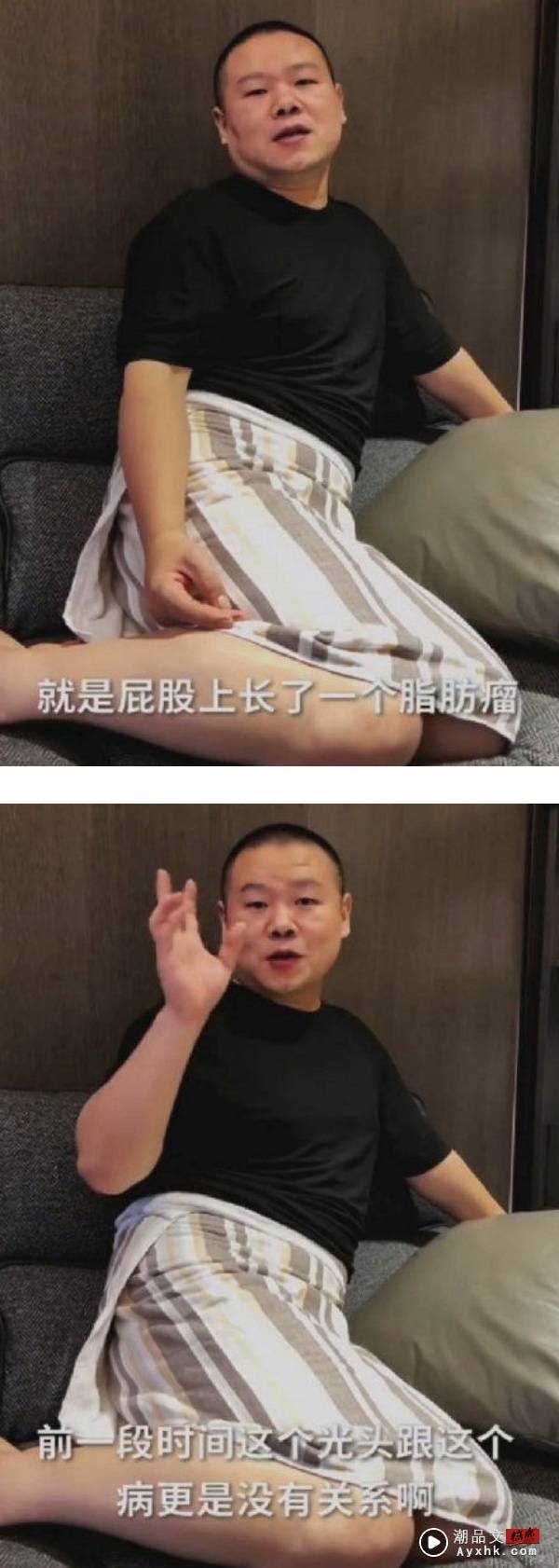 36岁岳云鹏“暴瘦+剃光头”疯传病危！曾透露：身体不舒服 娱乐资讯 图3张